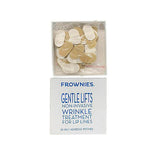 Gentle Lifts for Lip Lines